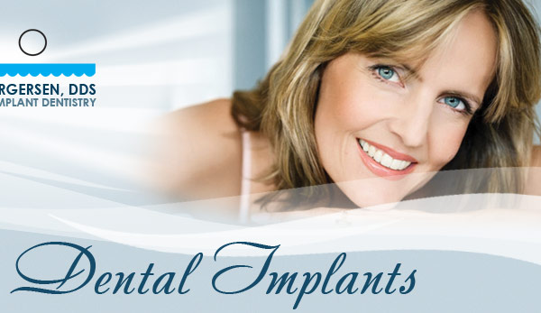 torgersen dental dental Implants